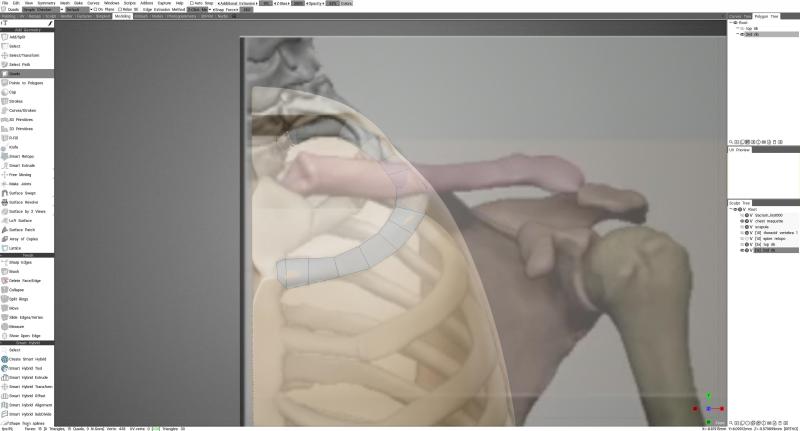 spine_recovered_autosave.3b.jpg